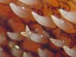 نمای جانبی دندانها
